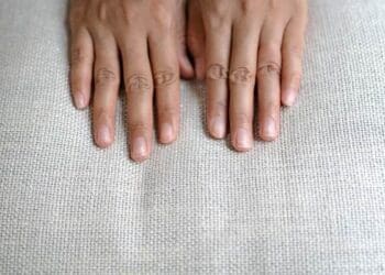11 Causes of Brittle Nails