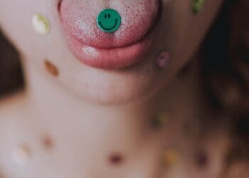 How to Get Rid of a White Tongue?