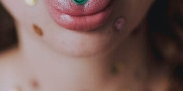 How to Get Rid of a White Tongue?