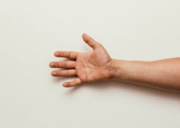 Why Is My Finger Numb? 13 Causes and Solutions for Relief