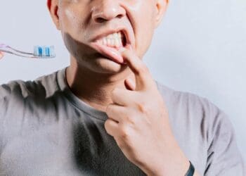 What Causes Bleeding Gums and How do You Prevent It
