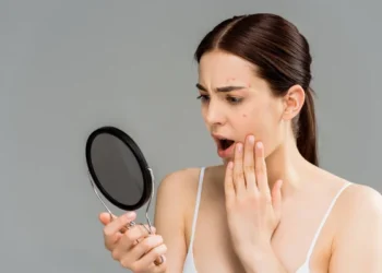 does caffeine cause acne