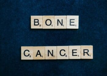 How Fast Does Bone Cancer Spread? 6 Important Symptoms