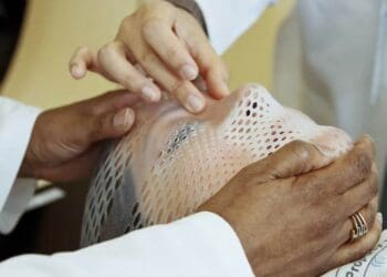 What does tonsil cancer look like?