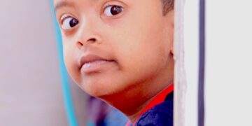 what causes autism during pregnacy